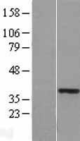 NBL1-11665 - HOXA11 Lysate