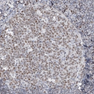 NBP1-83234 - HOXA3 / HOX1E