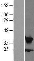 NBL1-11668 - HOXA5 Lysate