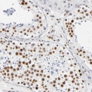 NBP1-83236 - HOXA6 / HOX1B