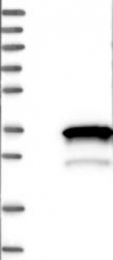 NBP1-83236 - HOXA6 / HOX1B