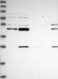 NBP1-83231 - HOXB1 / HOX2I