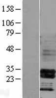 NBL1-11671 - HOXB4 Lysate