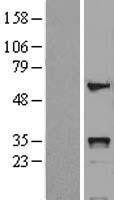 NBL1-11672 - HOXB5 Lysate