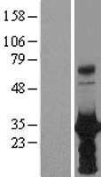 NBL1-11673 - HOXB6 Lysate