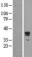 NBL1-11675 - HOXC10 Lysate