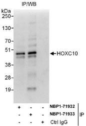NBP1-71932 - HOXC10 / HOX3I