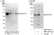 NBP1-71933 - HOXC10 / HOX3I