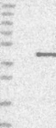 NBP1-83230 - HOXC11 / HOX3H