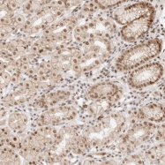 NBP1-81718 - HOXC5 / HOX3D