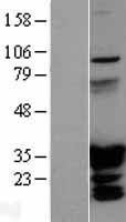 NBL1-11678 - HOXC6 Lysate