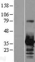 NBL1-11680 - HOXC8 Lysate