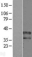 NBL1-11681 - HOXD1 Lysate