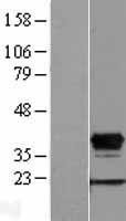 NBL1-11684 - HOXD8 Lysate