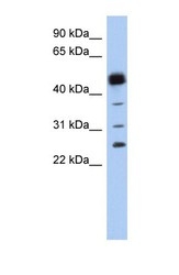 NBP1-54625 - PGD synthetase / PGDS