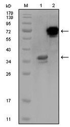 NBP1-47517 - HPS1