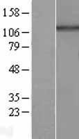 NBL1-11699 - HPS5 Lysate