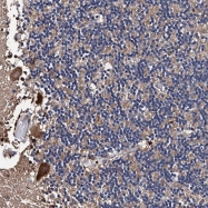 NBP1-92008 - TRMT112