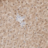 NBP1-82452 - Ribonuclease UK114 / HRSP12