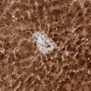 NBP1-82453 - Ribonuclease UK114 / HRSP12