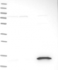 NBP1-82452 - Ribonuclease UK114 / HRSP12