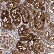 NBP1-83690 - HS1BP3