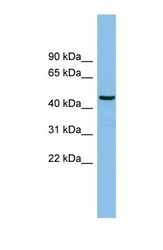 NBP1-57747 - HS1BP3