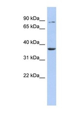 NBP1-58058 - HS3ST1 / 3OST