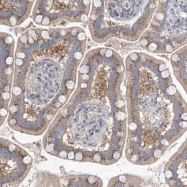 NBP1-86373 - HSBP1 / HSF1BP