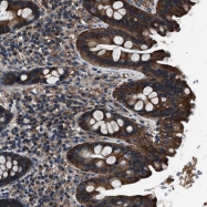 NBP1-84066 - HSCB / DNAJC20 / HSC20