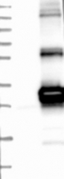 NBP1-84066 - HSCB / DNAJC20 / HSC20