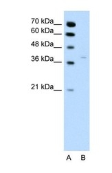 NBP1-56295 - 17-beta-HSD1 / HSD17B1