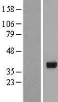 NBL1-11726 - HSD17B2 Lysate