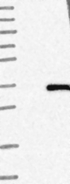 NBP1-80776 - 17-beta-HSD3 / HSD17B3