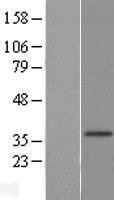 NBL1-11727 - HSD17B3 Lysate