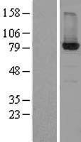 NBL1-11728 - HSD17B4 Lysate
