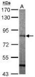 NBP1-33192 - 17-beta-HSD4 / HSD17B4