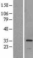 NBL1-11729 - HSD17B6 Lysate