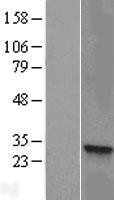 NBL1-11731 - HSD17B8 Lysate