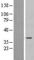 NBL1-11734 - HSD3B7 Lysate