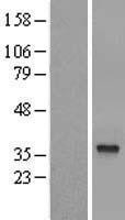 NBL1-11735 - HSDL1 Lysate