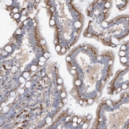 NBP1-86325 - HSF2BP