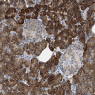 NBP1-92015 - SDR42E1