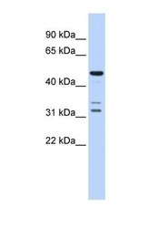NBP1-69684 - HTRA4
