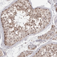 NBP1-89445 - HUS1