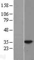 NBL1-11788 - HUS1 Lysate