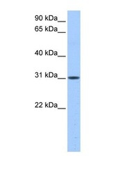 NBP1-54582 - HUS1B