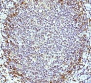 NBP1-06585 - HVCN1 / VSOP