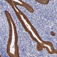 NBP1-83409 - HYAL1 / Hyaluronidase-1