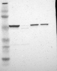 NBP1-83409 - HYAL1 / Hyaluronidase-1